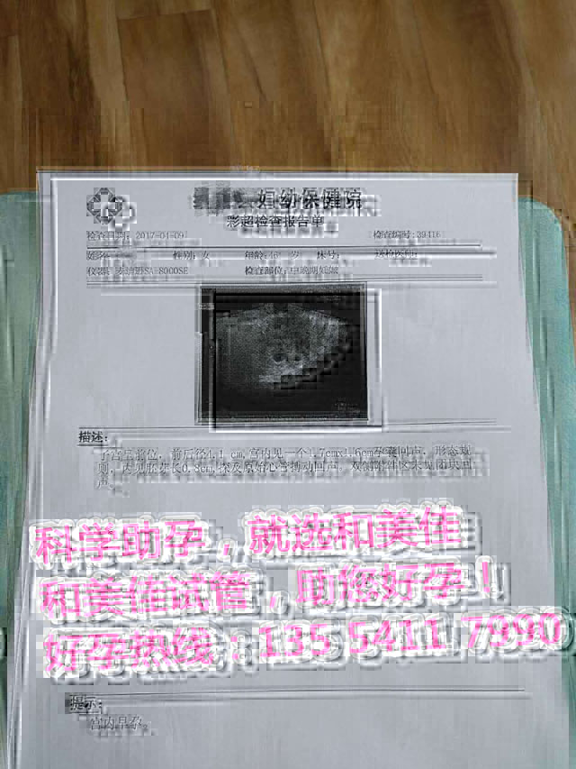 一个月的等待，顺利听到胎心