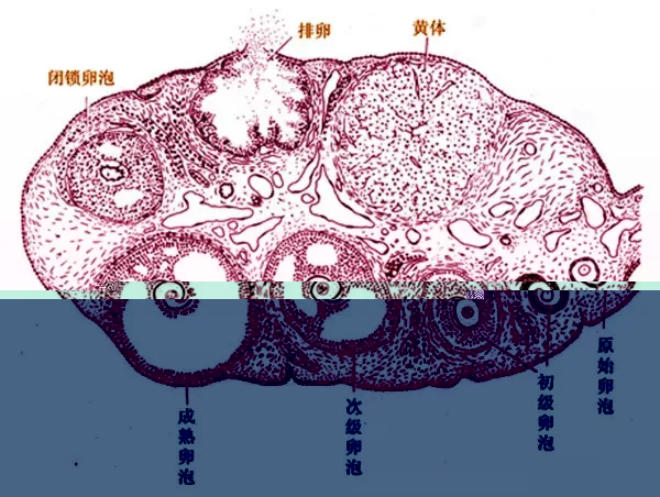 为什么不排卵：未破裂卵泡黄素化综合征