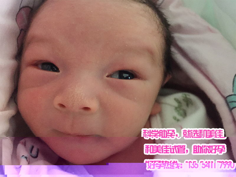 染色体易位代妈成功植入两个健康胚胎